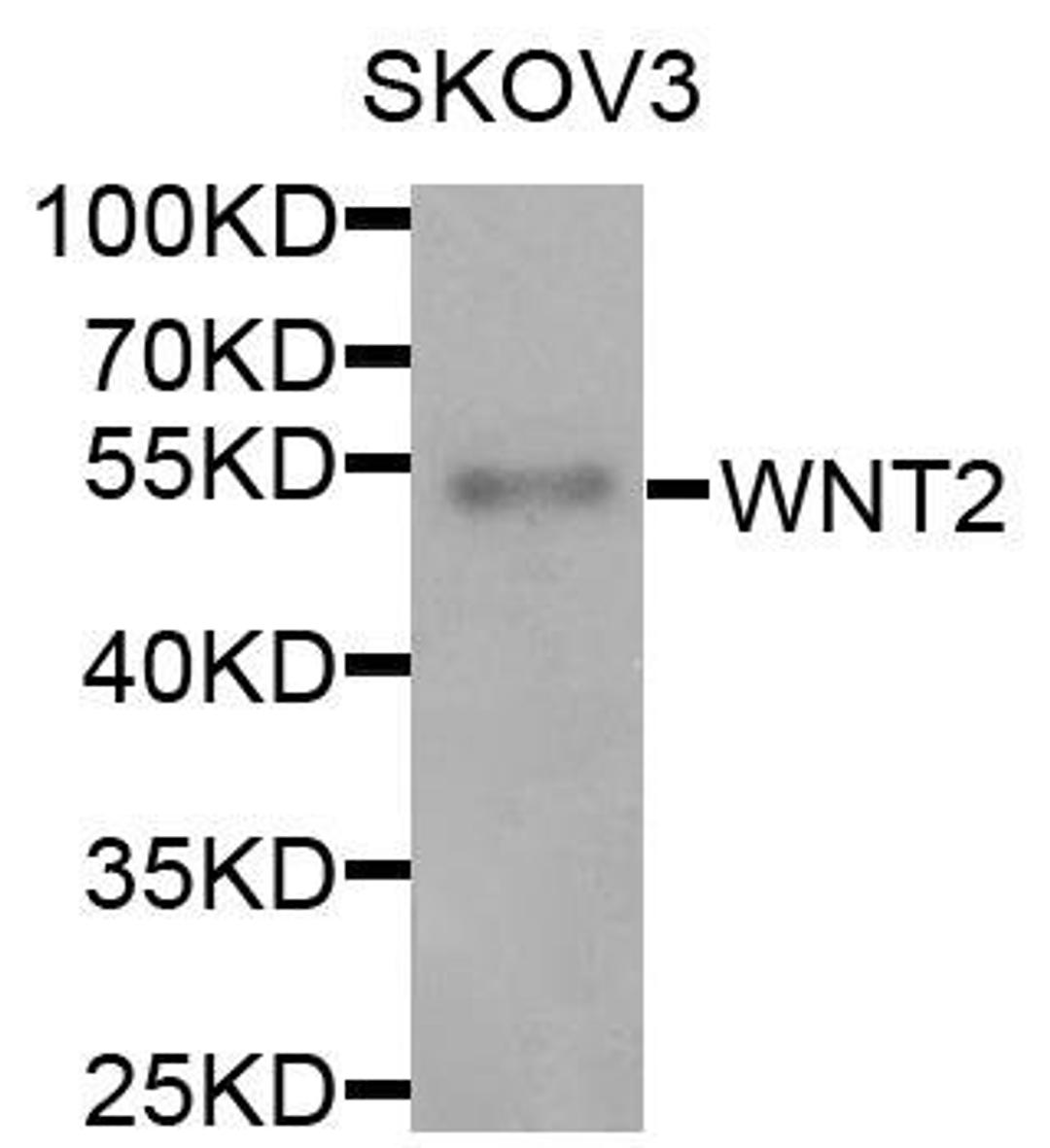 Western blot analysis of extracts of various cells using WNT2 antibody