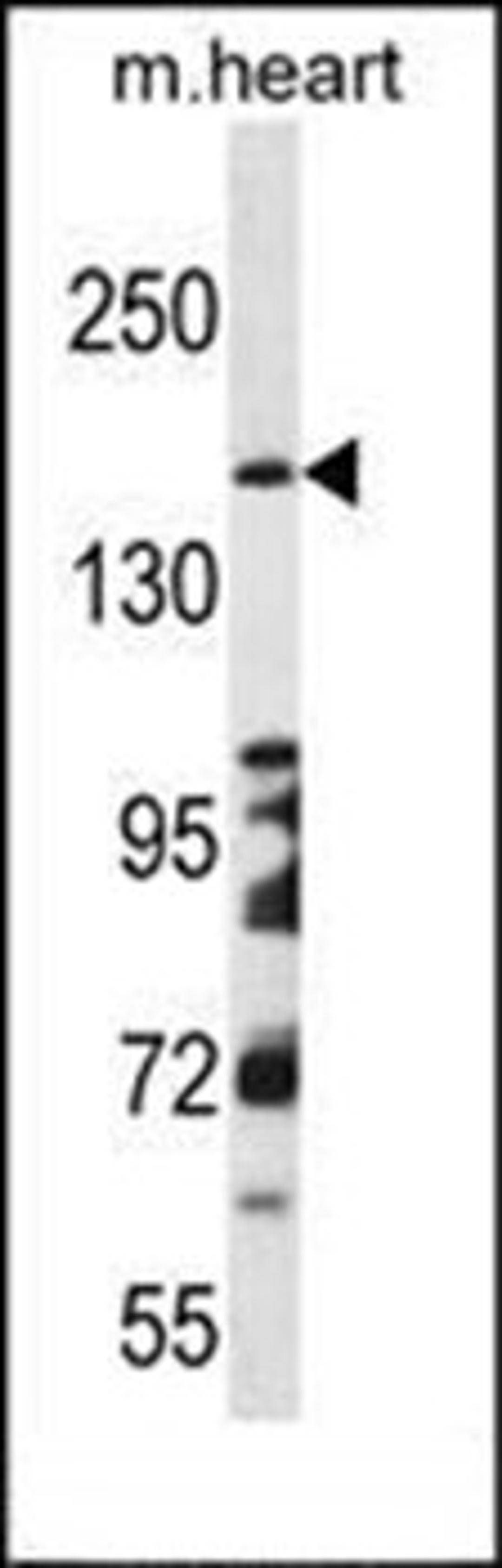 Western blot analysis of mouse heart tissue lysates (35ug/lane) using DCC antibody (Center)