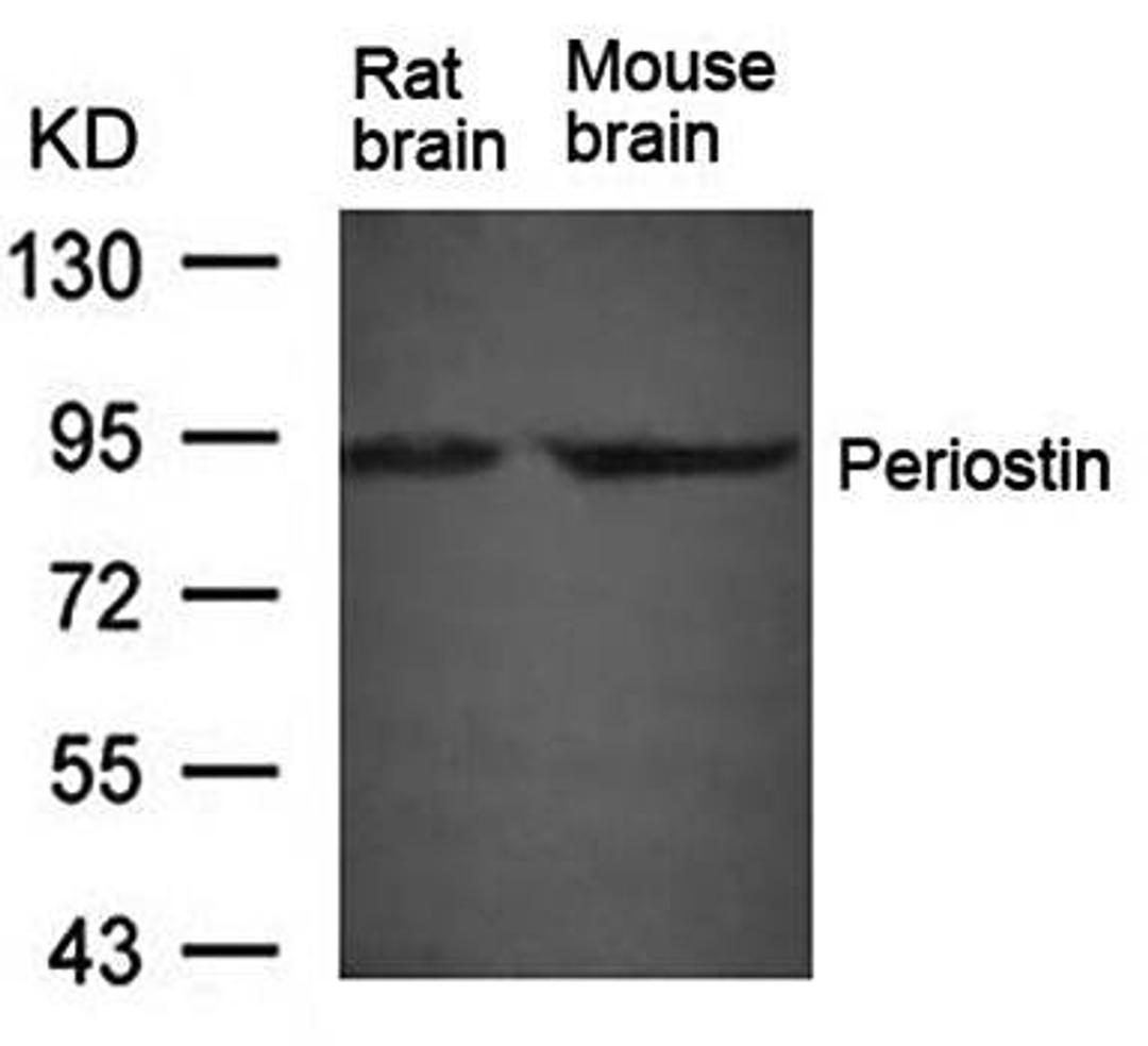 Western blot analysis of Periostin antibody in Rat brain and Mouse brain tissue lysate