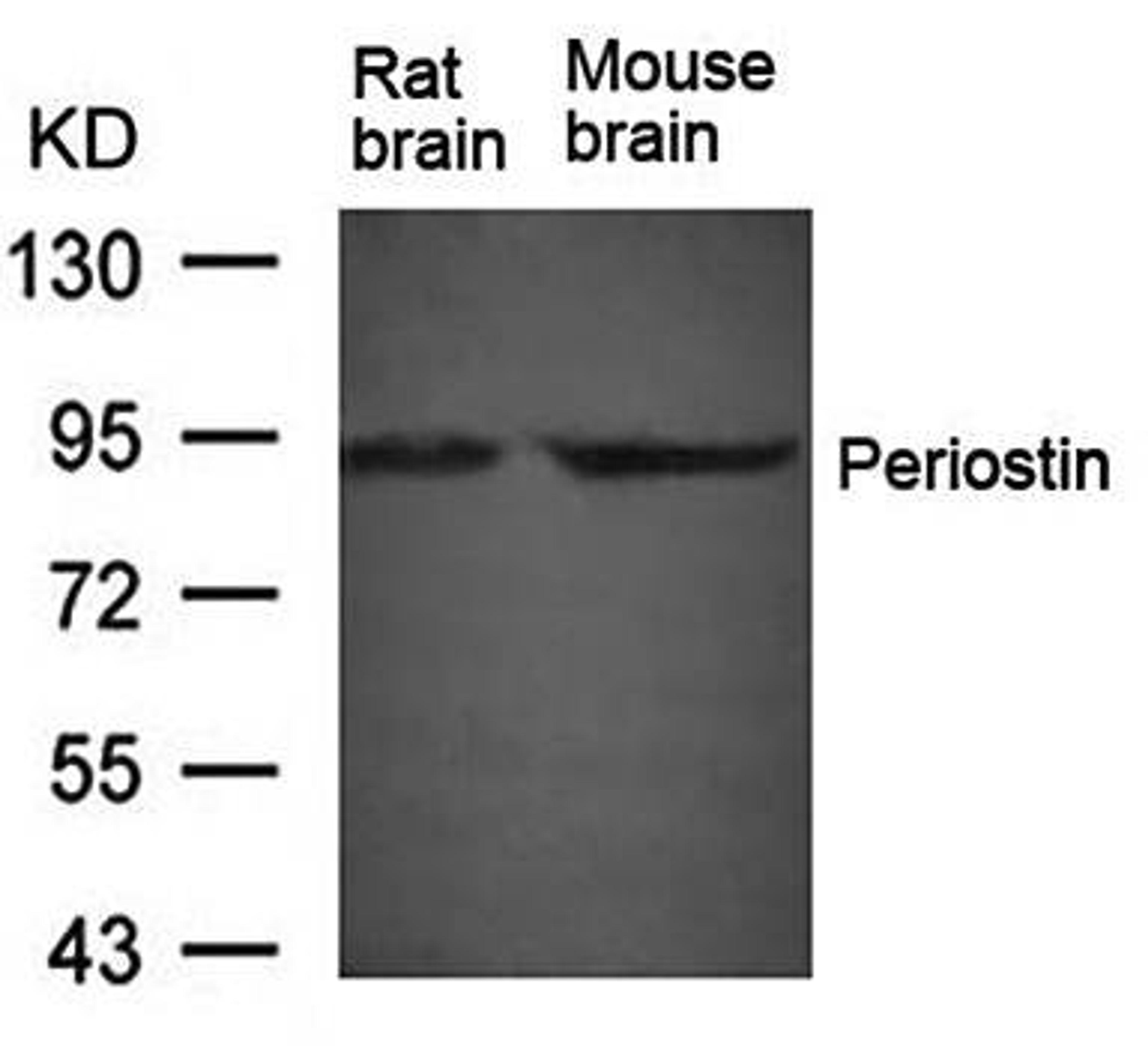 Western blot analysis of Periostin antibody in Rat brain and Mouse brain tissue lysate