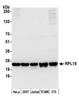 Detection of human and mouse RPL18 by western blot.