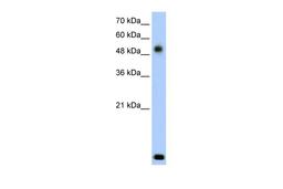 Antibody used in WB on Human Jurkat 2.5 ug/ml.