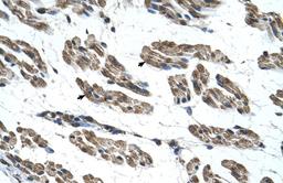 Antibody used in IHC on Human Muscle.