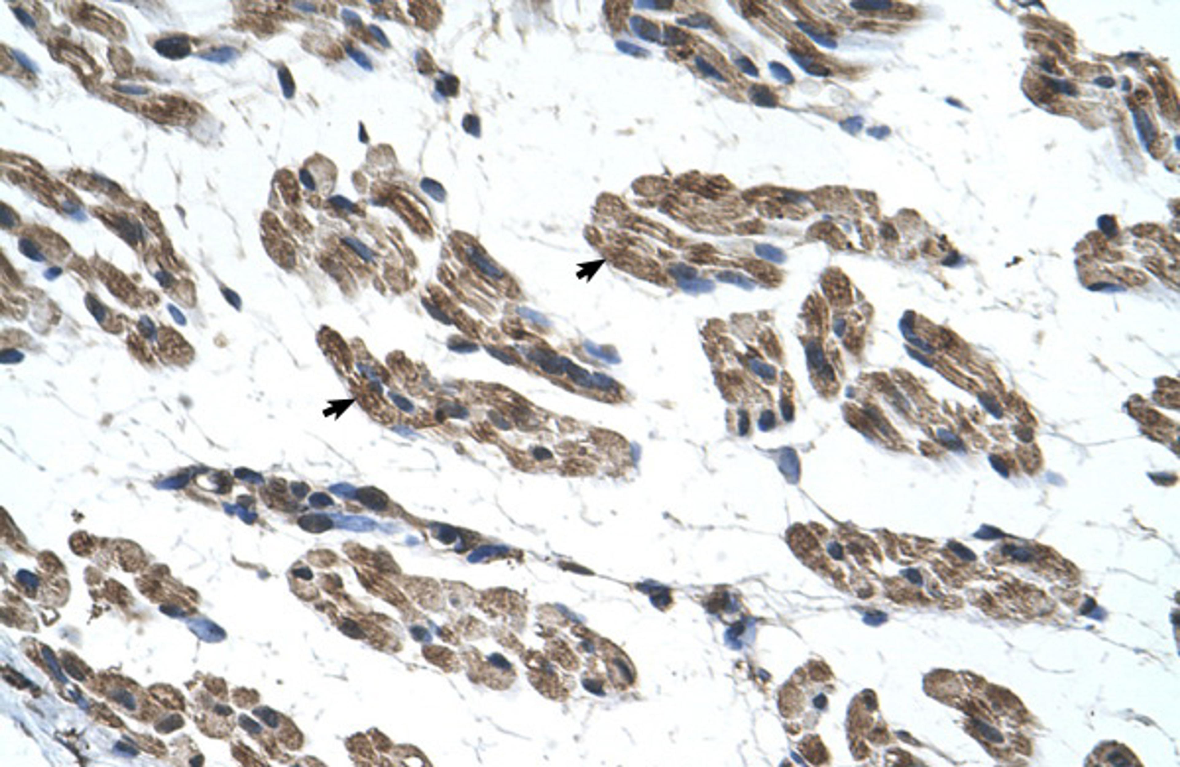 Antibody used in IHC on Human Muscle.