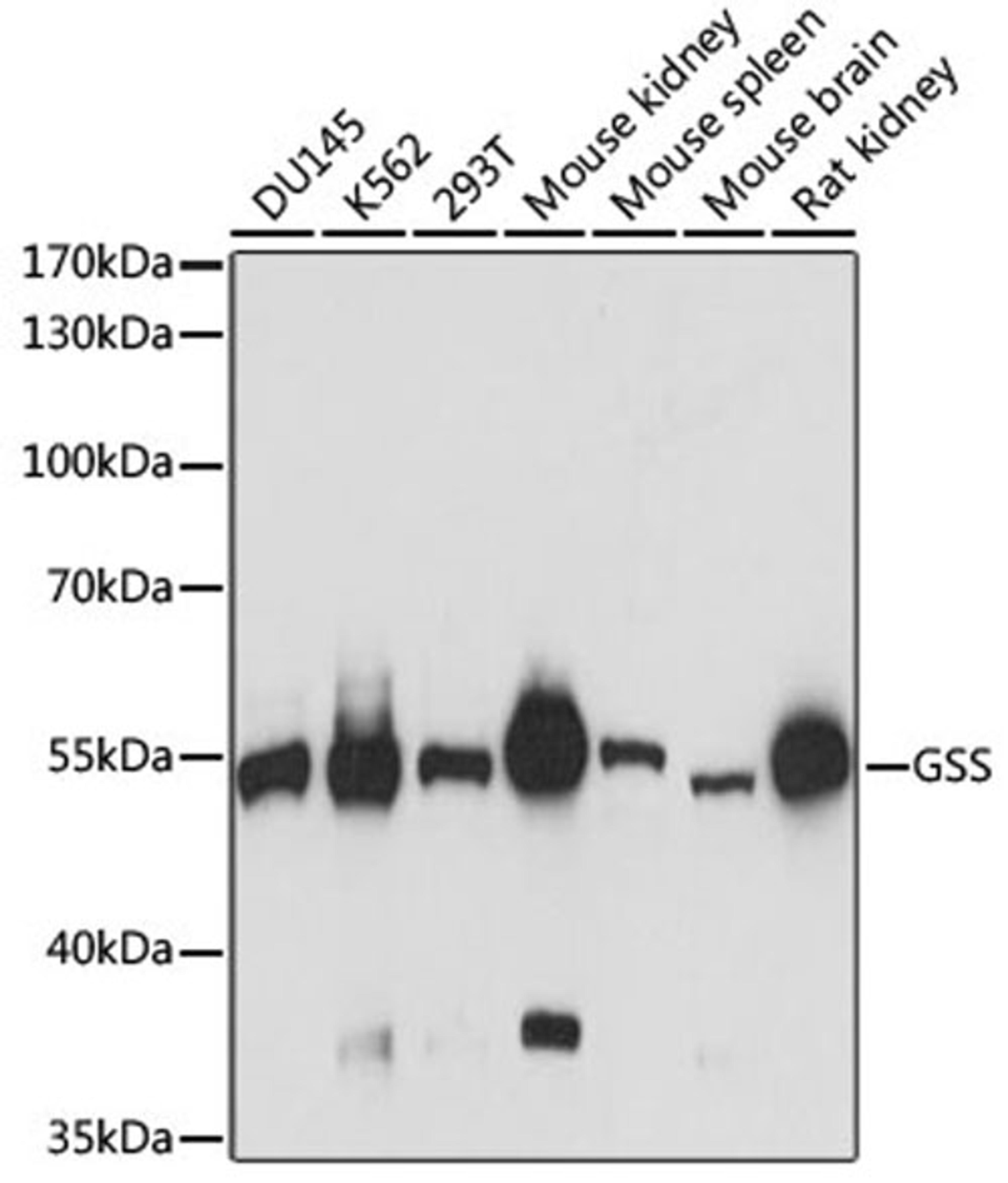 Western blot - GSS antibody (A14535)