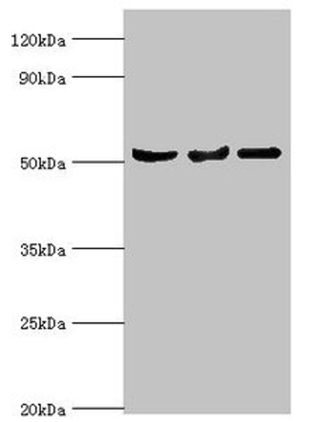 Western blot. All lanes: Protein Z-dependent protease inhibitor antibody at 3ug/ml. Lane 1: Mouse liver tissue. Lane 2: HepG2 whole cell lysate. Lane 3: LO2 whole cell lysate. Secondary. Goat polyclonal to rabbit IgG at 1/10000 dilution. Predicted band size: 51 kDa. Observed band size: 51 kDa. 