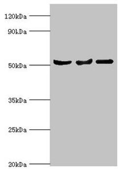 Western blot. All lanes: Protein Z-dependent protease inhibitor antibody at 3ug/ml. Lane 1: Mouse liver tissue. Lane 2: HepG2 whole cell lysate. Lane 3: LO2 whole cell lysate. Secondary. Goat polyclonal to rabbit IgG at 1/10000 dilution. Predicted band size: 51 kDa. Observed band size: 51 kDa. 