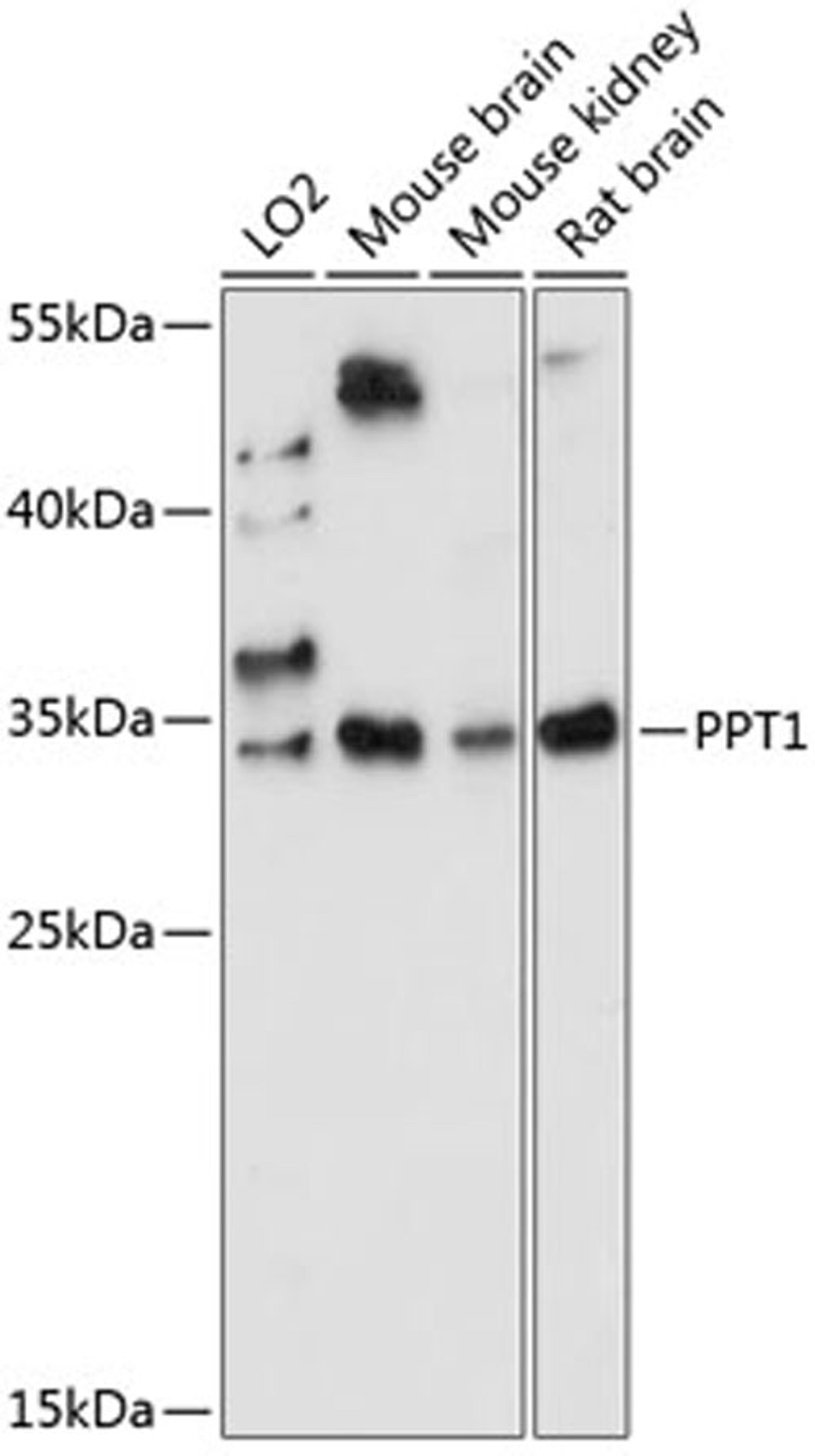 Western blot - PPT1 antibody (A14769)