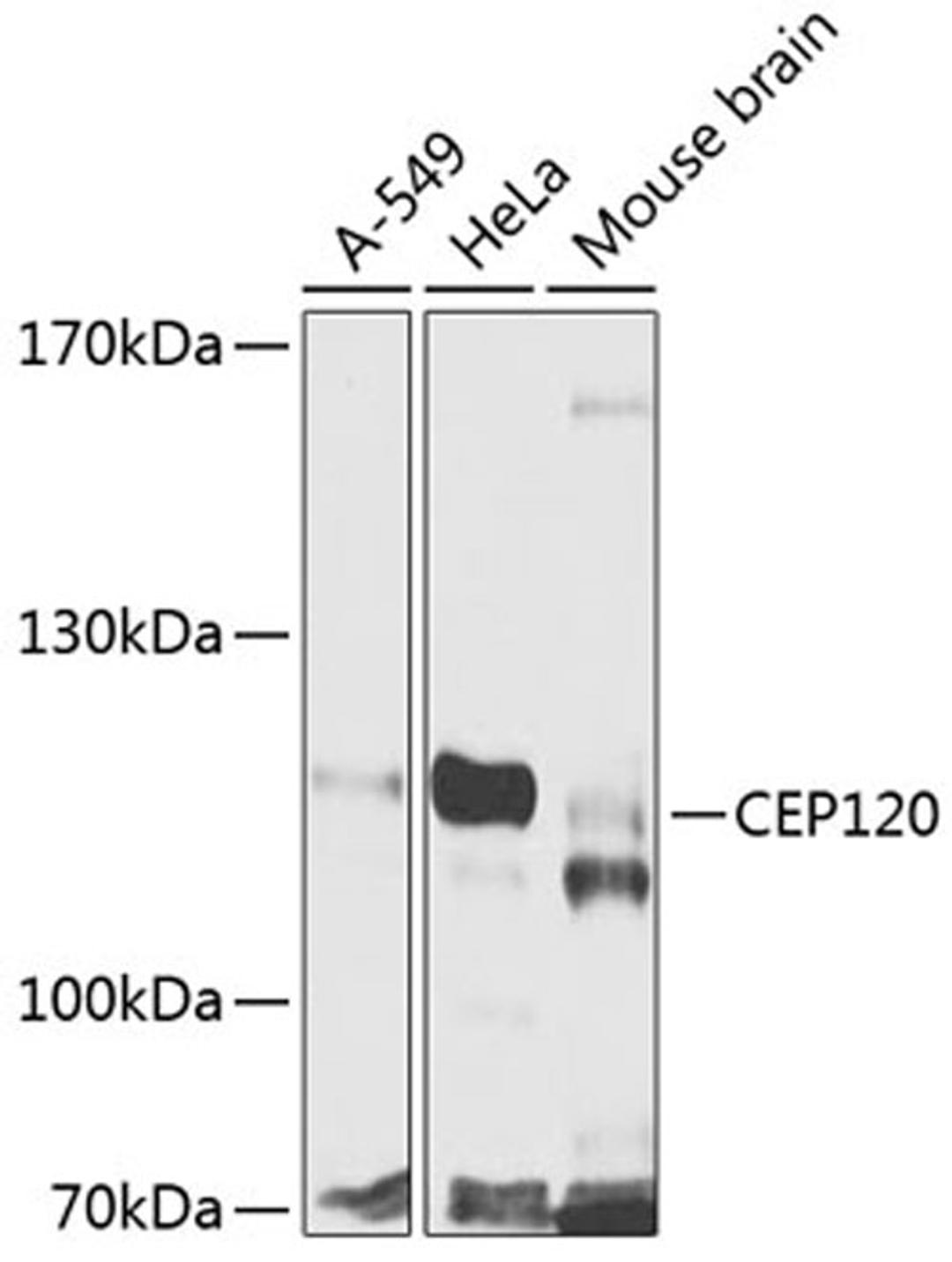 Western blot - CEP120 antibody (A8004)