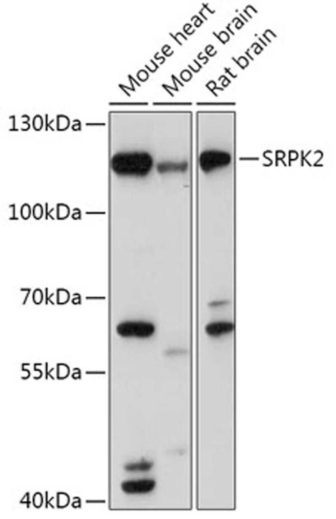 Western blot - SRPK2 antibody (A17536)