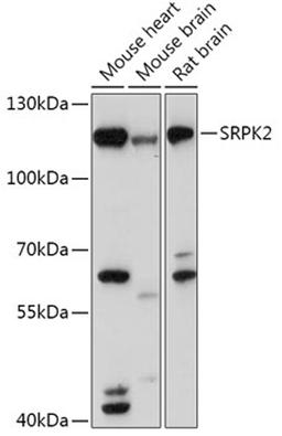 Western blot - SRPK2 antibody (A17536)