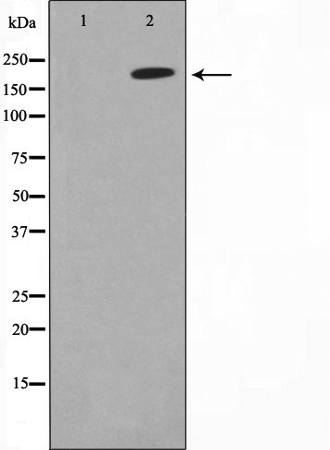 Western blot analysis of HeLa cell lysate using Collagen Valpha 1 antibody