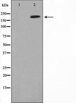 Western blot analysis of HeLa cell lysate using Collagen Valpha 1 antibody