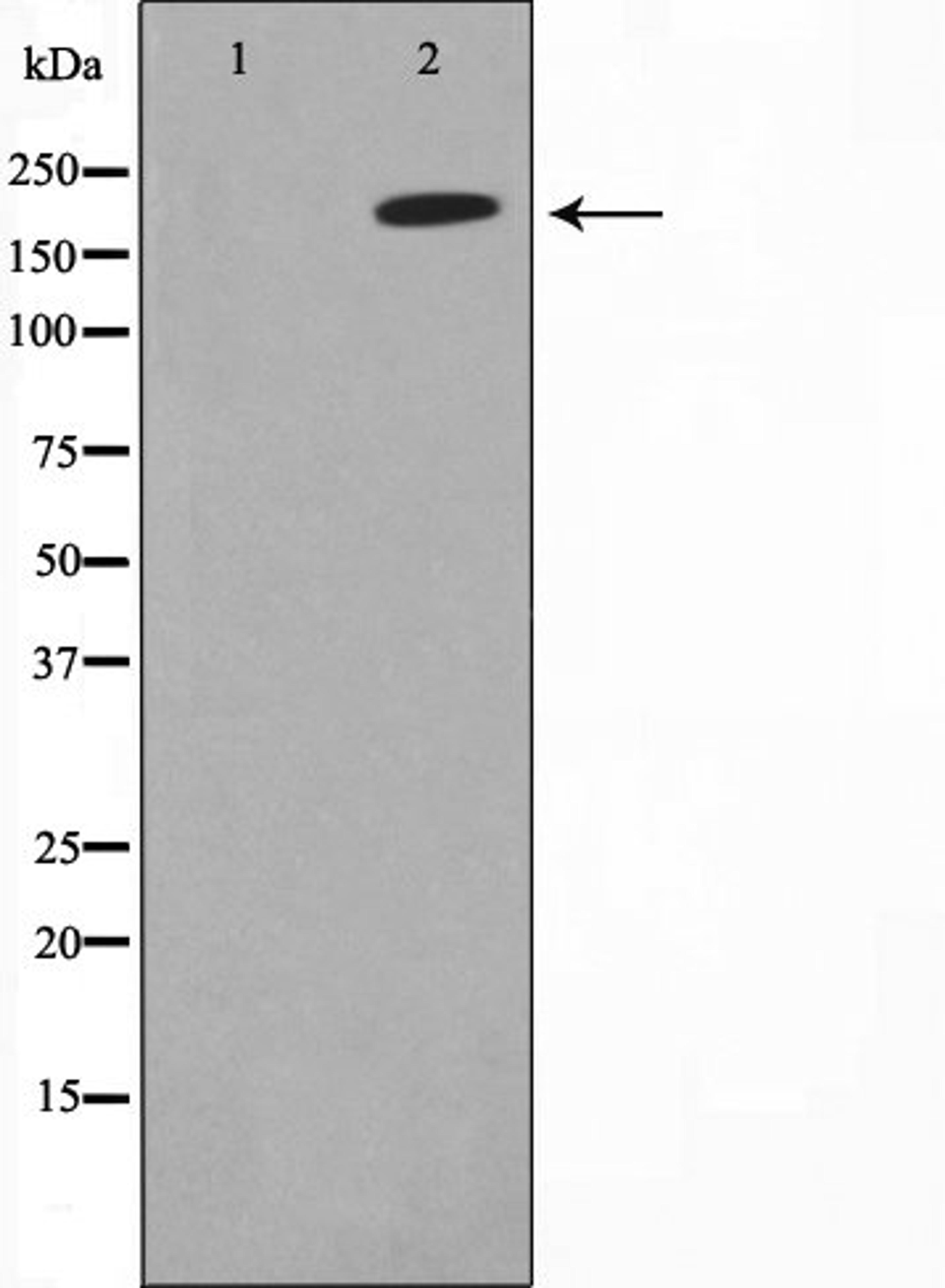 Western blot analysis of HeLa cell lysate using Collagen Valpha 1 antibody