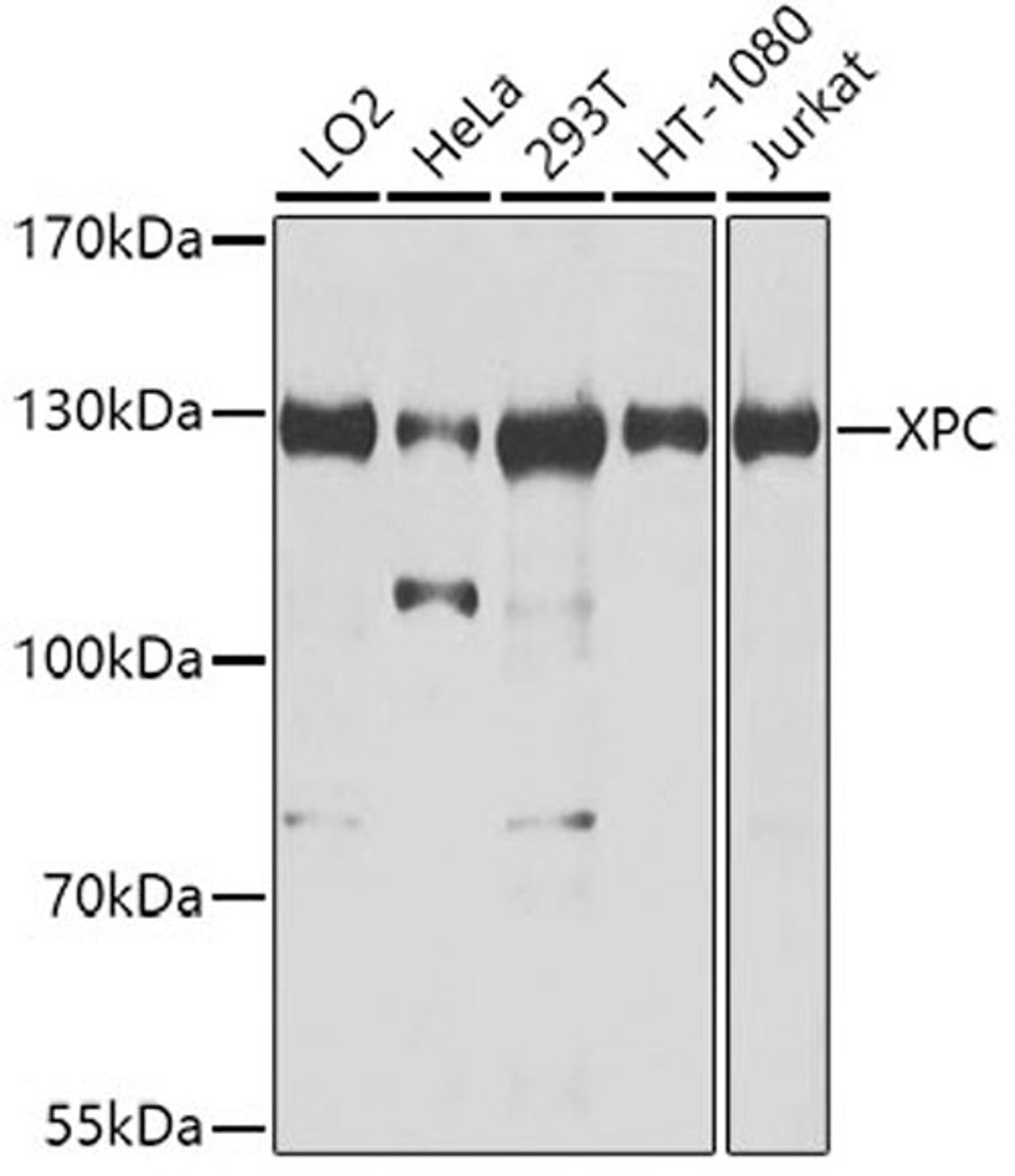 Western blot - XPC antibody (A8354)