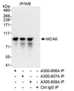 Detection of human MCAK by western blot of immunoprecipitates.