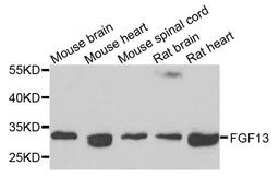 Western blot analysis of extracts of various cells using FGF13 antibody