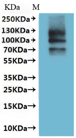 CSB-MP5879DO(A4) is detected by Mouse anti-6*His monoclonal antibody.