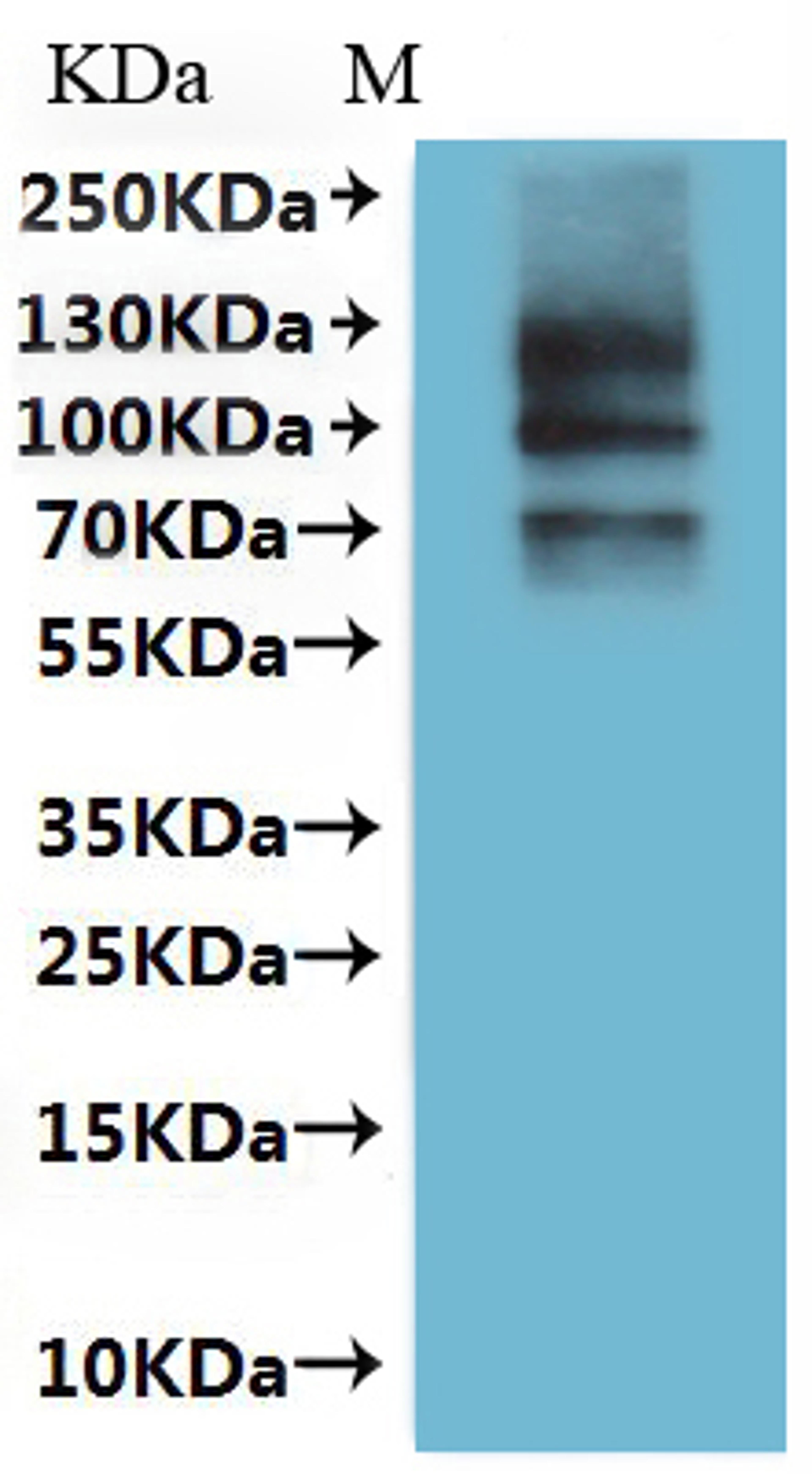 CSB-MP5879DO(A4) is detected by Mouse anti-6*His monoclonal antibody.