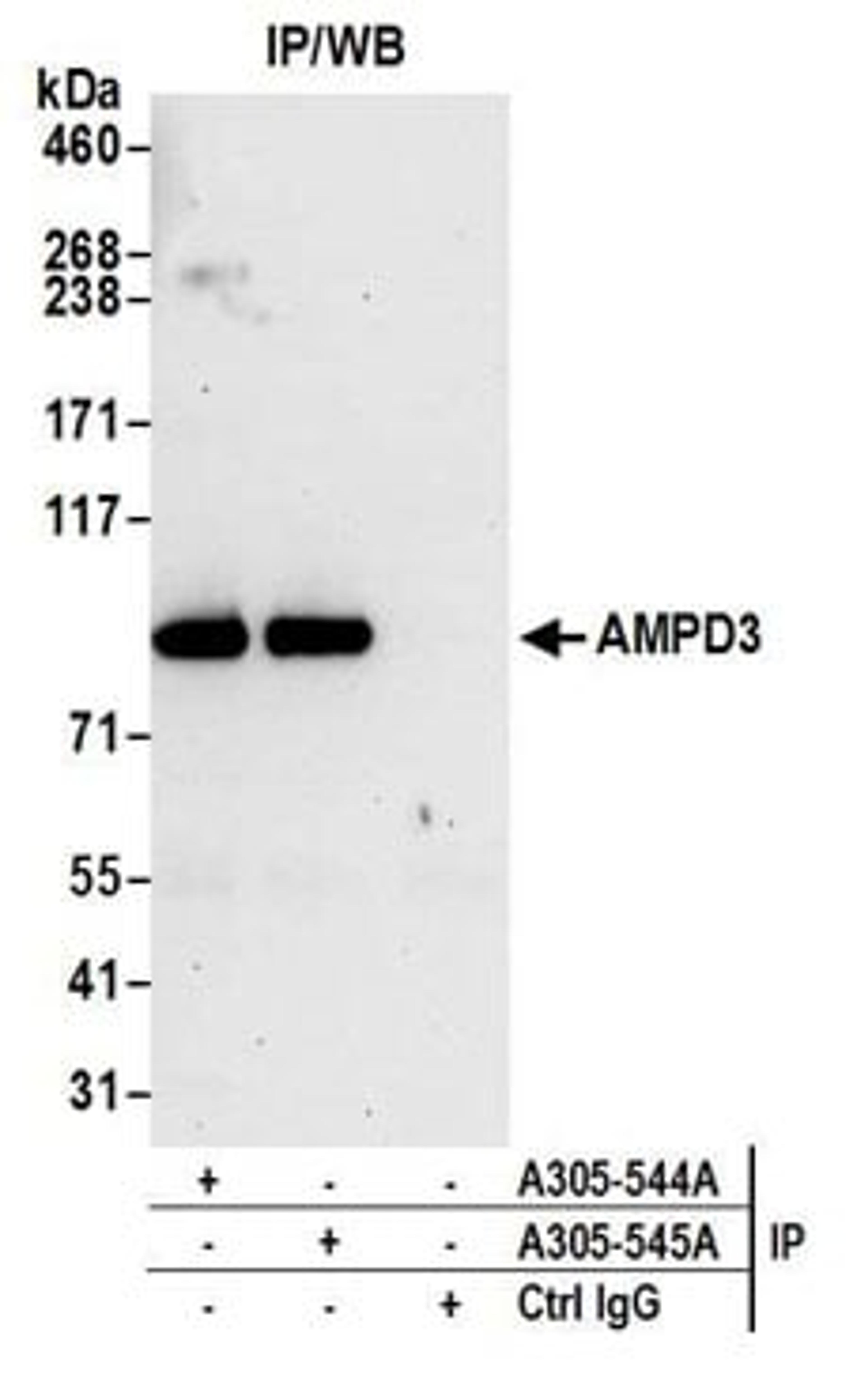 Detection of human AMPD3 by western blot of immunoprecipitates.