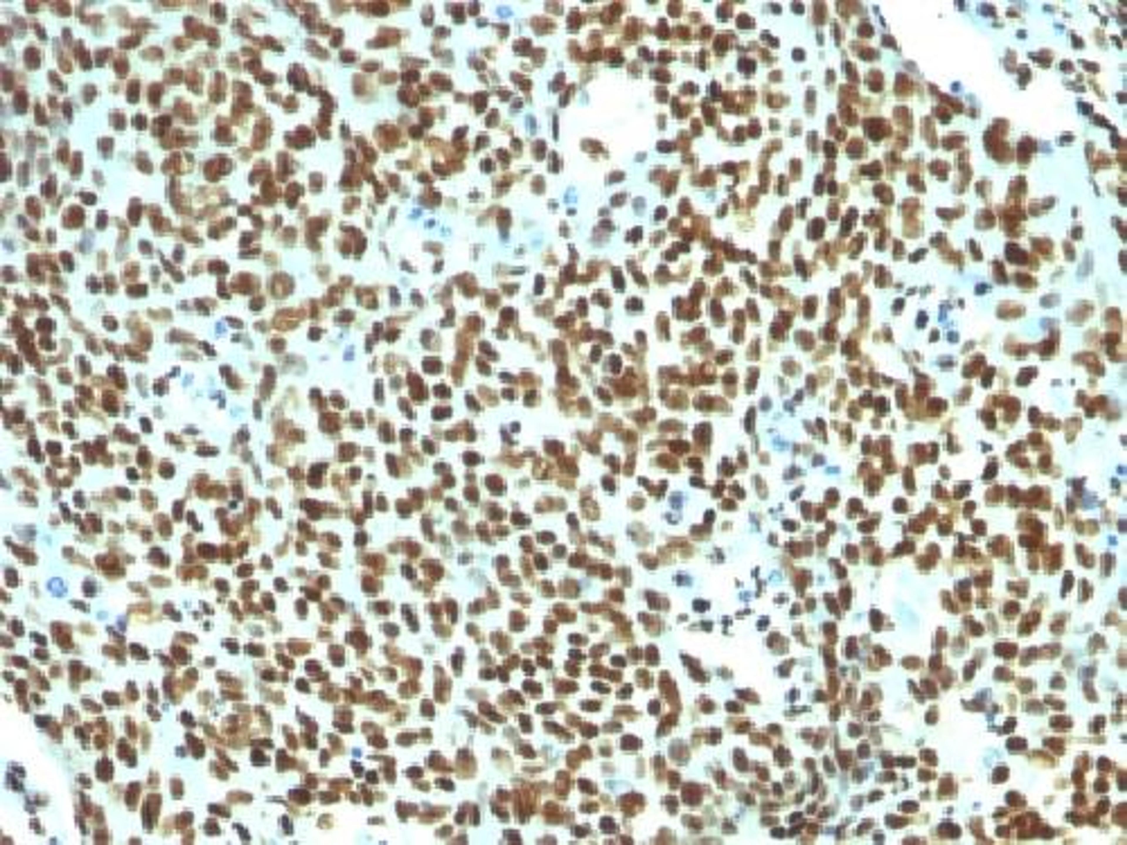 Immunohistochemical staining of human Tonsil tissue using Nuclear Antigen antibody