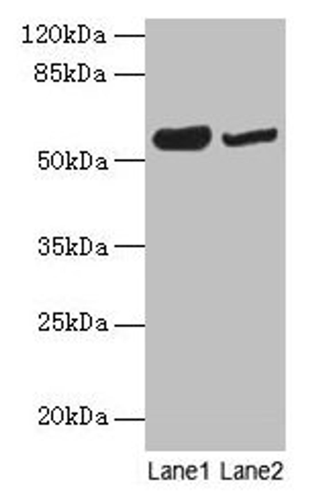 Western blot. All lanes: NOSTRIN antibody at 6µg/ml. Lane 1: Mouse heart tissue. Lane 2: Mouse brain tissue. Secondary. Goat polyclonal to rabbit IgG at 1/10000 dilution. Predicted band size: 58, 55, 49, 65 kDa. Observed band size: 58 kDa