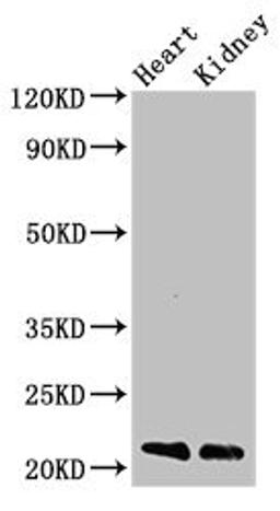 Western Blot. Positive WB detected in: Mouse heart tissue, Mouse kidney tissue. All lanes: SDC4 antibody at 3ug/ml. Secondary. Goat polyclonal to rabbit IgG at 1/50000 dilution. Predicted band size: 22, 17 kDa. Observed band size: 22 kDa.
