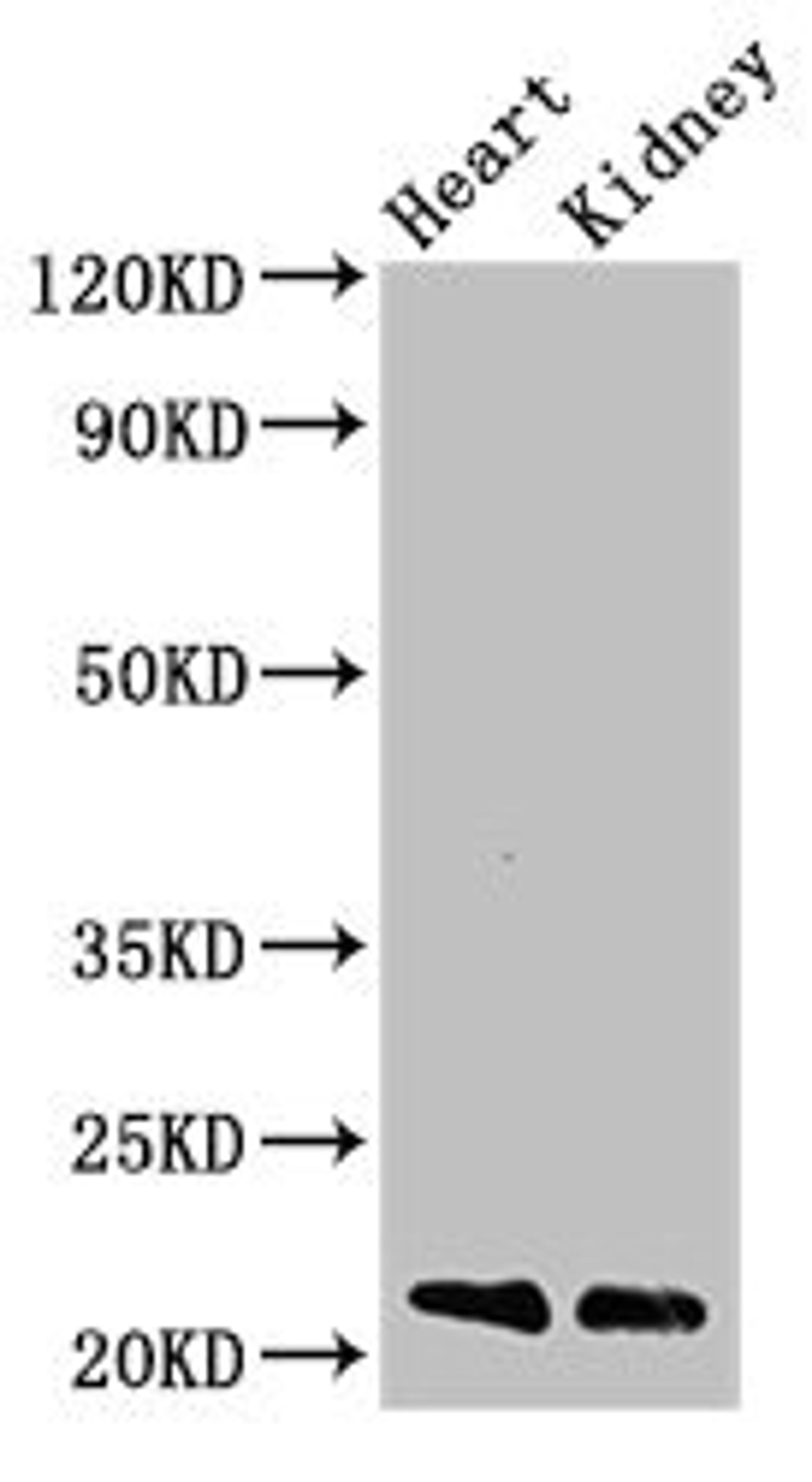 Western Blot. Positive WB detected in: Mouse heart tissue, Mouse kidney tissue. All lanes: SDC4 antibody at 3ug/ml. Secondary. Goat polyclonal to rabbit IgG at 1/50000 dilution. Predicted band size: 22, 17 kDa. Observed band size: 22 kDa.