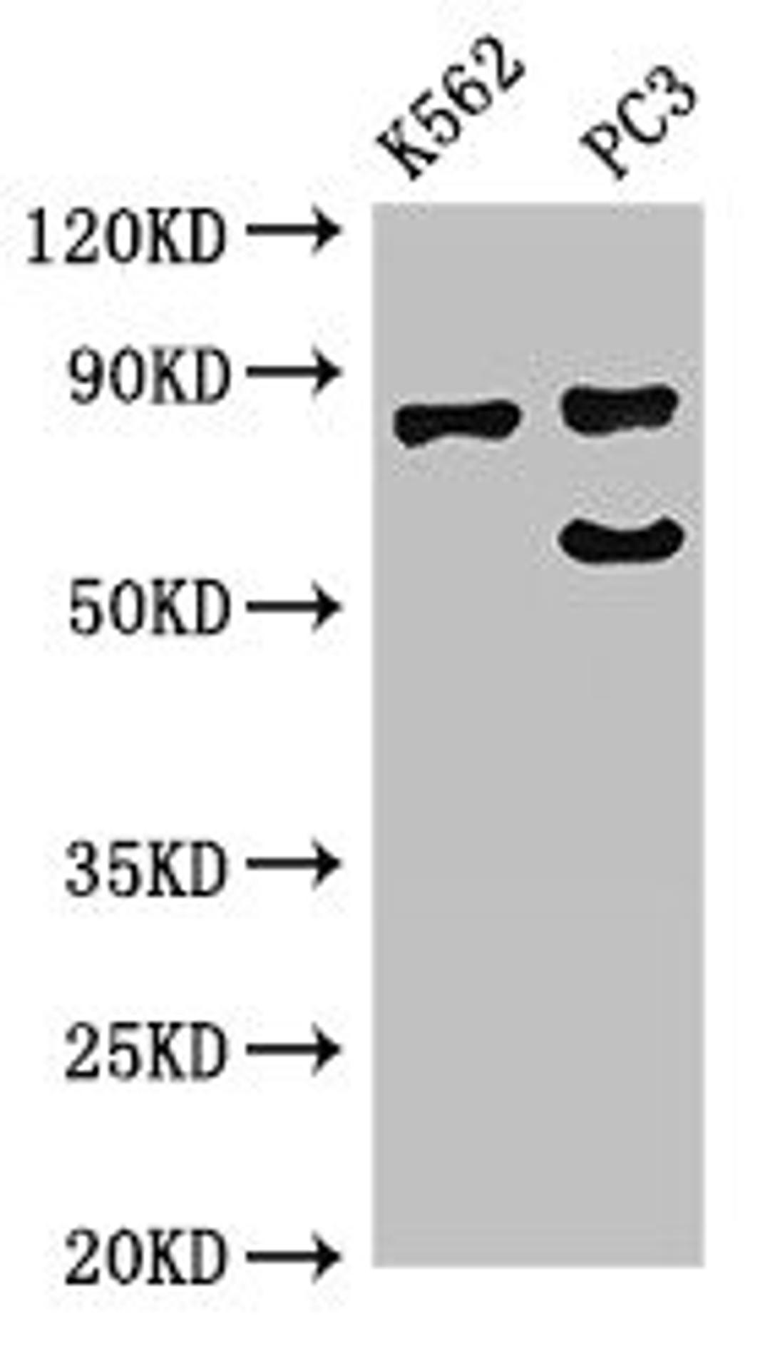 Western Blot. Positive WB detected in: K562 whole cell lysate, PC-3 whole cell lysate. All lanes: SP110 antibody at 2.7ug/ml. Secondary. Goat polyclonal to rabbit IgG at 1/50000 dilution. Predicted band size: 79, 47, 62, 29, 82, 63 kDa. Observed band size: 79, 64 kDa.
