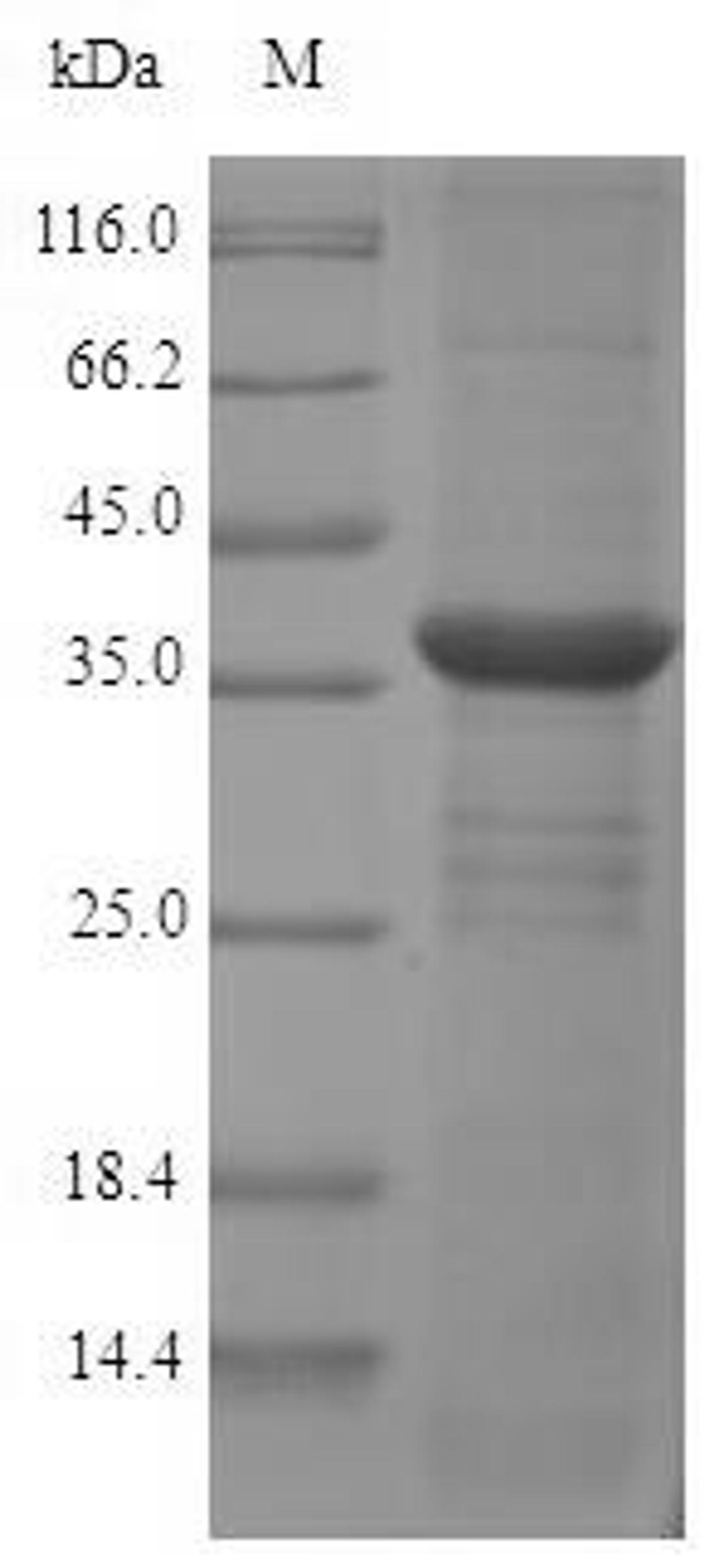 (Tris-Glycine gel) Discontinuous SDS-PAGE (reduced) with 5% enrichment gel and 15% separation gel.