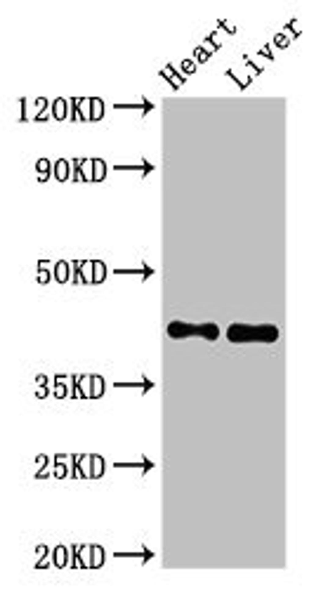 Western Blot. Positive WB detected in: Rat heart tissue, Mouse liver tissue. All lanes: MCAT antibody at 2.5ug/ml. Secondary. Goat polyclonal to rabbit IgG at 1/50000 dilution. Predicted band size: 43, 20 kDa. Observed band size: 43 kDa. 