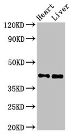 Western Blot. Positive WB detected in: Rat heart tissue, Mouse liver tissue. All lanes: MCAT antibody at 2.5ug/ml. Secondary. Goat polyclonal to rabbit IgG at 1/50000 dilution. Predicted band size: 43, 20 kDa. Observed band size: 43 kDa. 