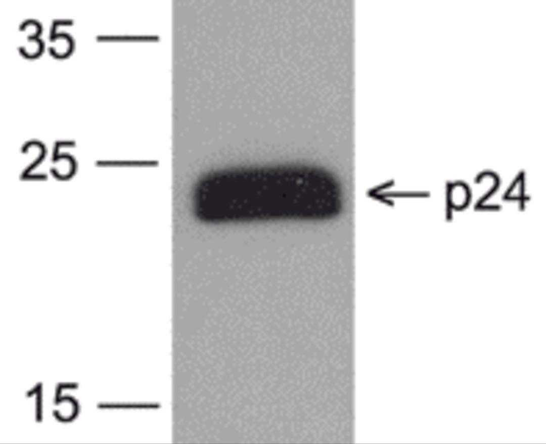 Western blot analysis of 20 ng of HIV-1 p24 protein with PM-6585-biotin at 0.2 μg/mL.