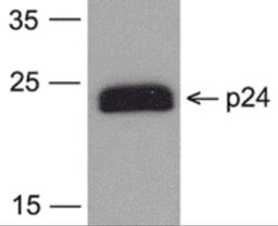 Western blot analysis of 20 ng of HIV-1 p24 protein with PM-6585-biotin at 0.2 μg/mL.