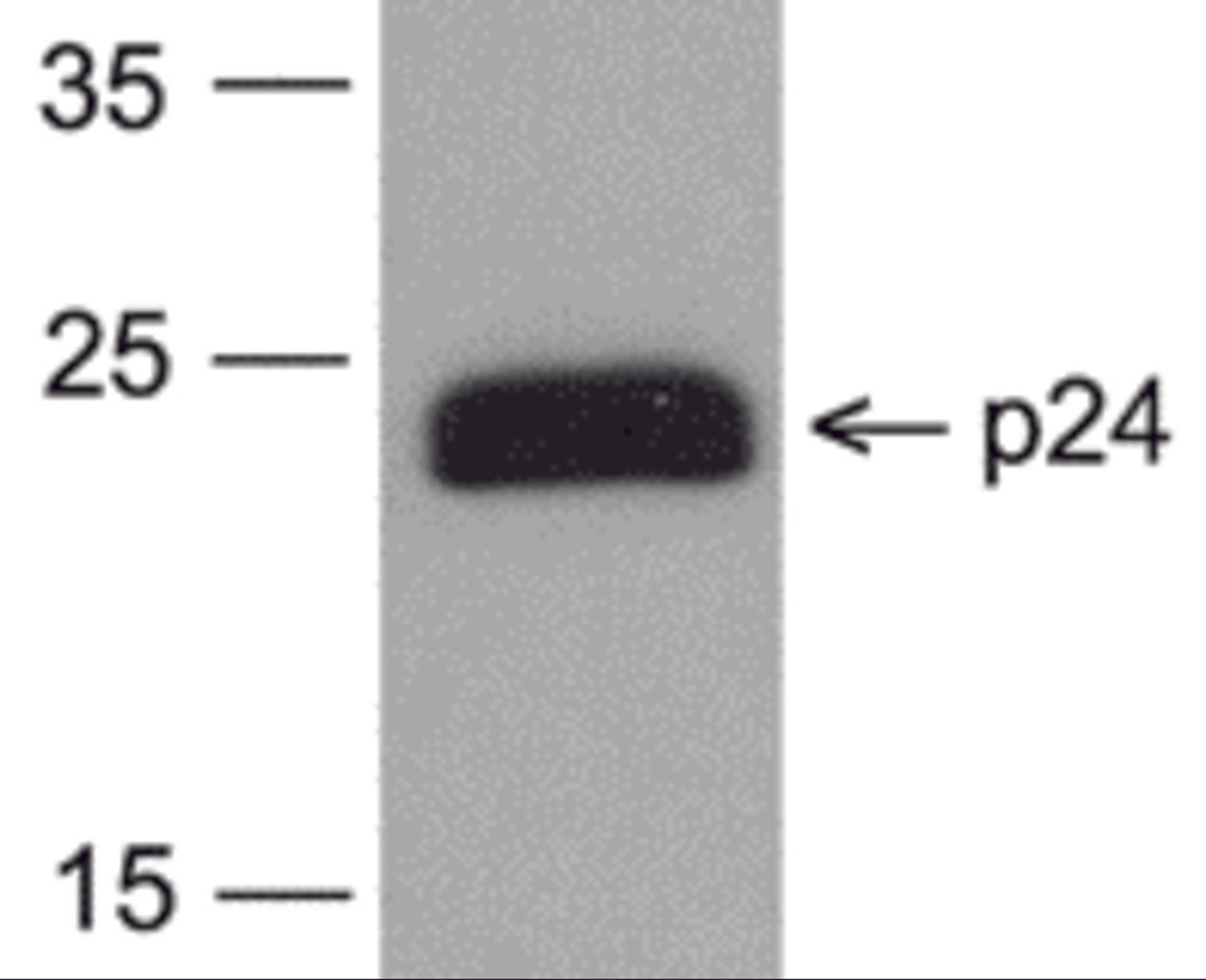 Western blot analysis of 20 ng of HIV-1 p24 protein with PM-6585-biotin at 0.2 μg/mL.