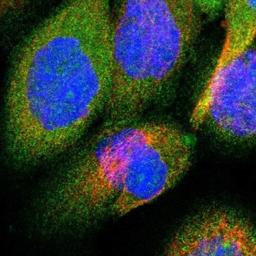 Immunocytochemistry/Immunofluorescence: OSBPL3 Antibody [NBP1-82968] - Staining of human cell line A-431 shows positivity in nucleoli & cytoplasm.