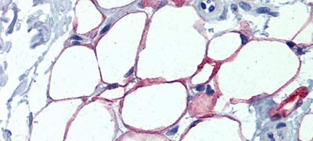 Antibody used in IHC on Human Adipocytes.