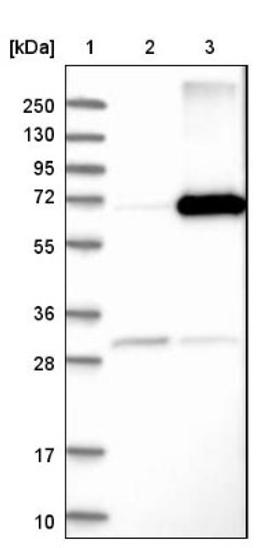 Western Blot: Arylsulfatase D Antibody [NBP1-87486] - Lane 1: Marker [kDa] 250, 130, 95, 72, 55, 36, 28, 17, 10<br/>Lane 2: Negative control (vector only transfected HEK293T lysate)<br/>Lane 3: Over-expression lysate (Co-expressed with a C-terminal myc-DDK tag (~3.1 kDa) in mammalian HEK293T cells, LY419791)