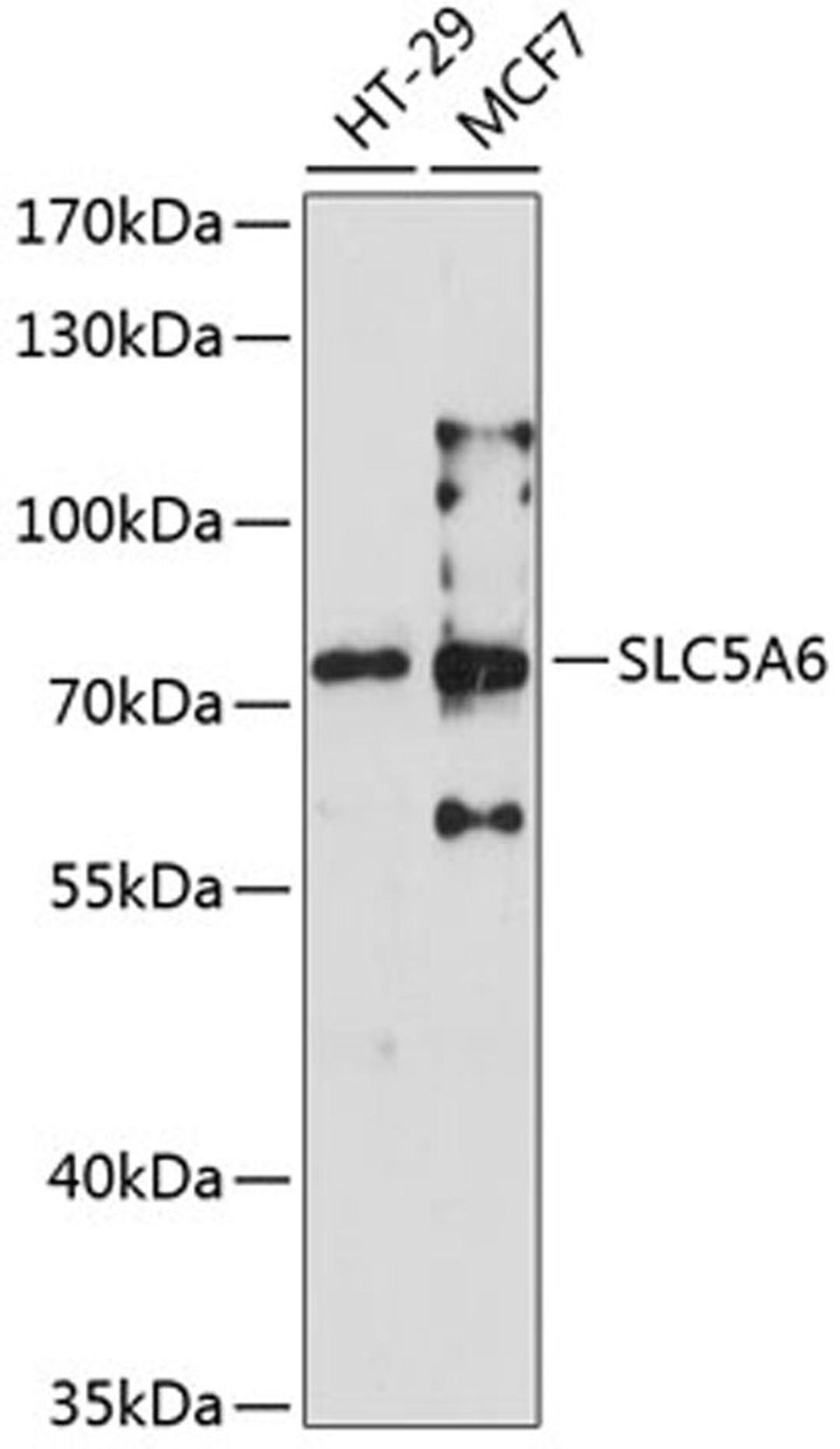 Western blot - SLC5A6 antibody (A6434)