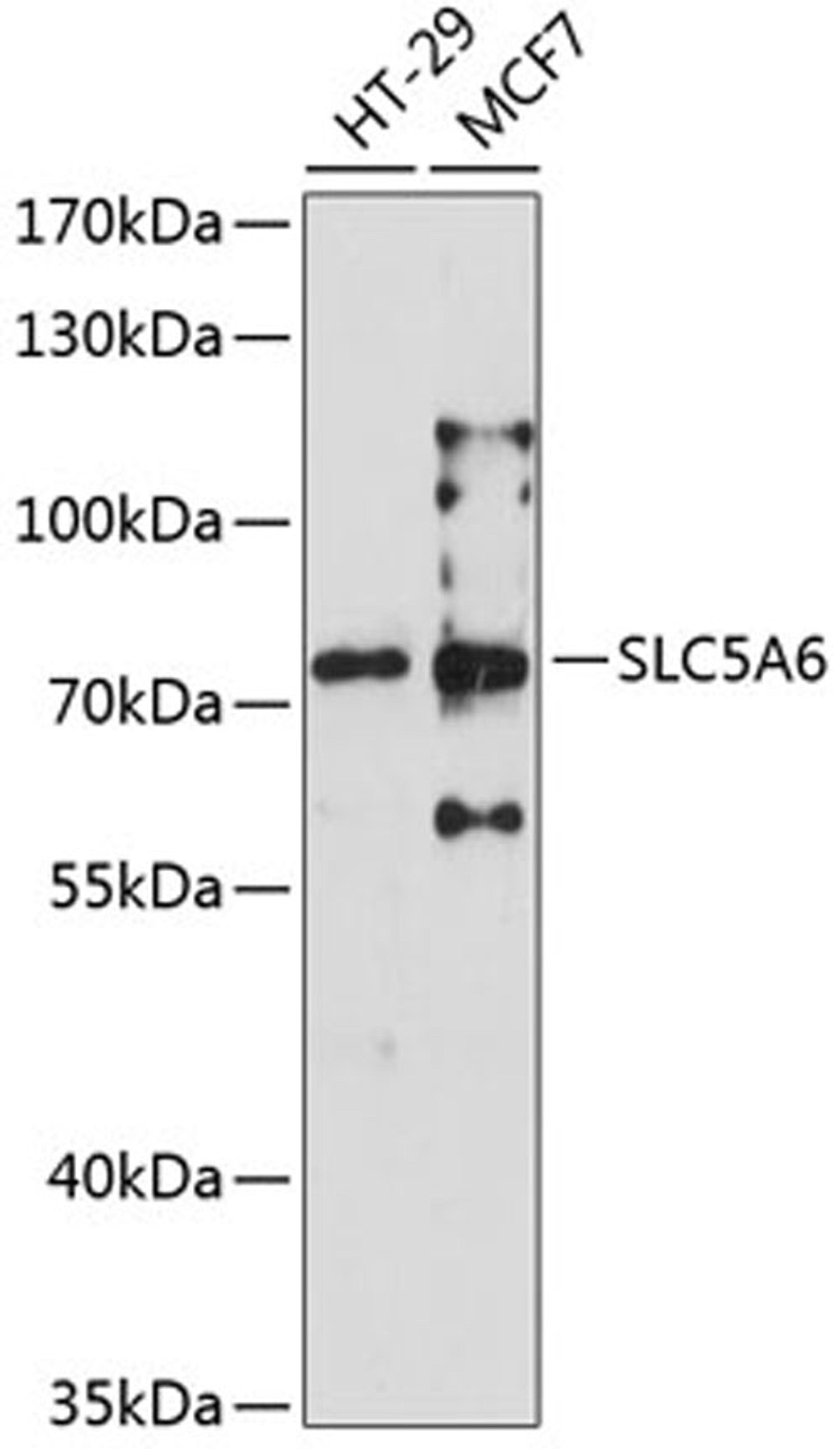 Western blot - SLC5A6 antibody (A6434)