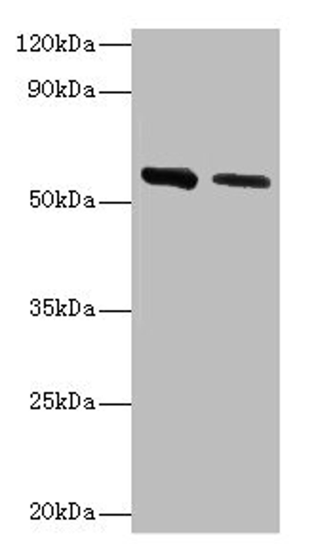 Western blot. All lanes: ADSL antibody at 2µg/ml. Lane 1: Hela whole cell lysate. Lane 2: Mouse heart tissue. Secondary. Goat polyclonal to rabbit IgG at 1/10000 dilution. Predicted band size: 55, 49 kDa. Observed band size: 55 kDa
