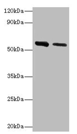 Western blot. All lanes: ADSL antibody at 2µg/ml. Lane 1: Hela whole cell lysate. Lane 2: Mouse heart tissue. Secondary. Goat polyclonal to rabbit IgG at 1/10000 dilution. Predicted band size: 55, 49 kDa. Observed band size: 55 kDa