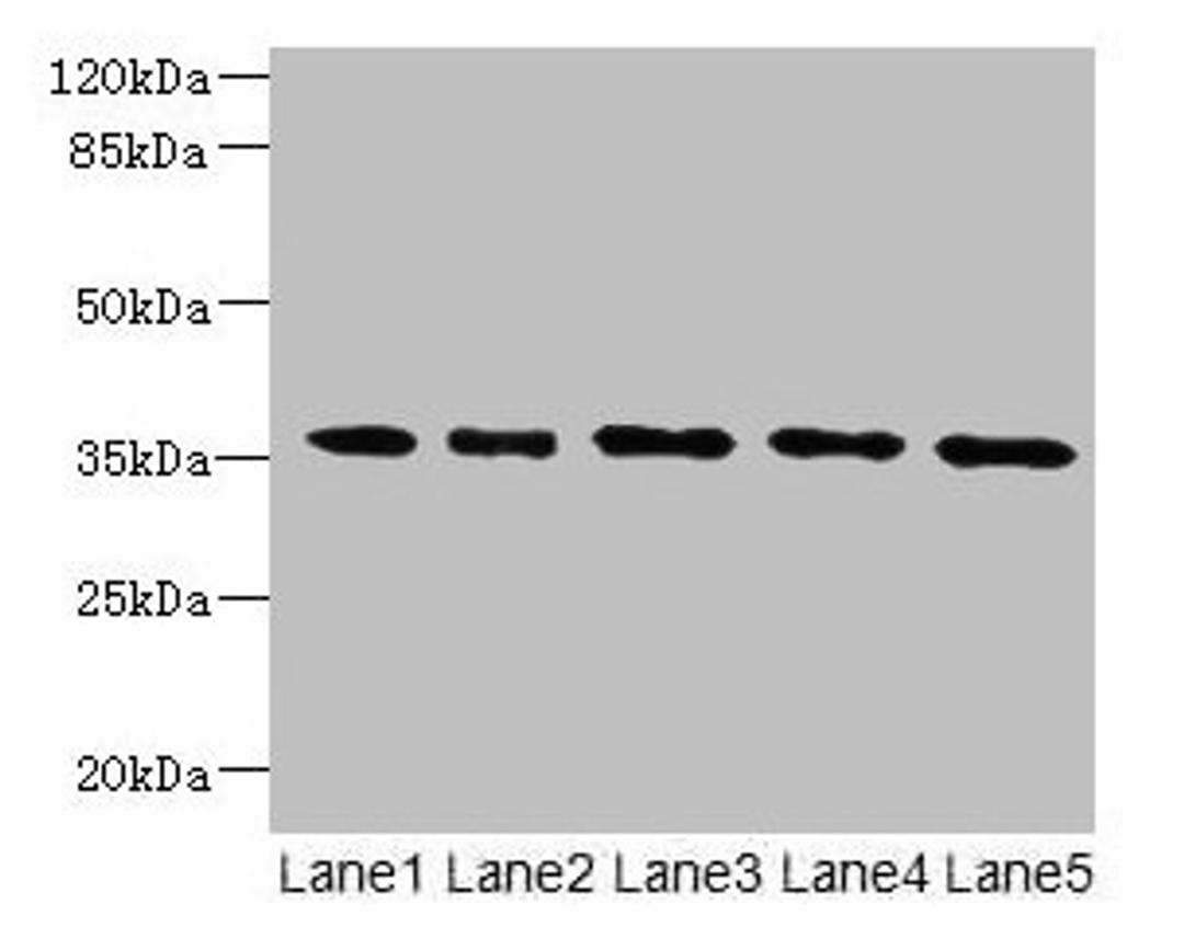 Western blot. All lanes: OXNAD1 antibody at 4µg/ml. Lane 1: Mouse large intestine tissue. Lane 2: Mouse lung tissue. Lane 3: K562 whole cell lysate. Lane 4: U251 whole cell lysate. Lane 5: A549 whole cell lysate. Secondary. Goat polyclonal to rabbit IgG at 1/10000 dilution. Predicted band size: 35 kDa. Observed band size: 35 kDa