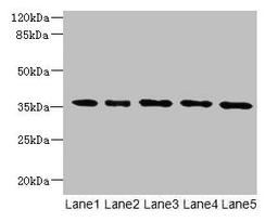 Western blot. All lanes: OXNAD1 antibody at 4µg/ml. Lane 1: Mouse large intestine tissue. Lane 2: Mouse lung tissue. Lane 3: K562 whole cell lysate. Lane 4: U251 whole cell lysate. Lane 5: A549 whole cell lysate. Secondary. Goat polyclonal to rabbit IgG at 1/10000 dilution. Predicted band size: 35 kDa. Observed band size: 35 kDa