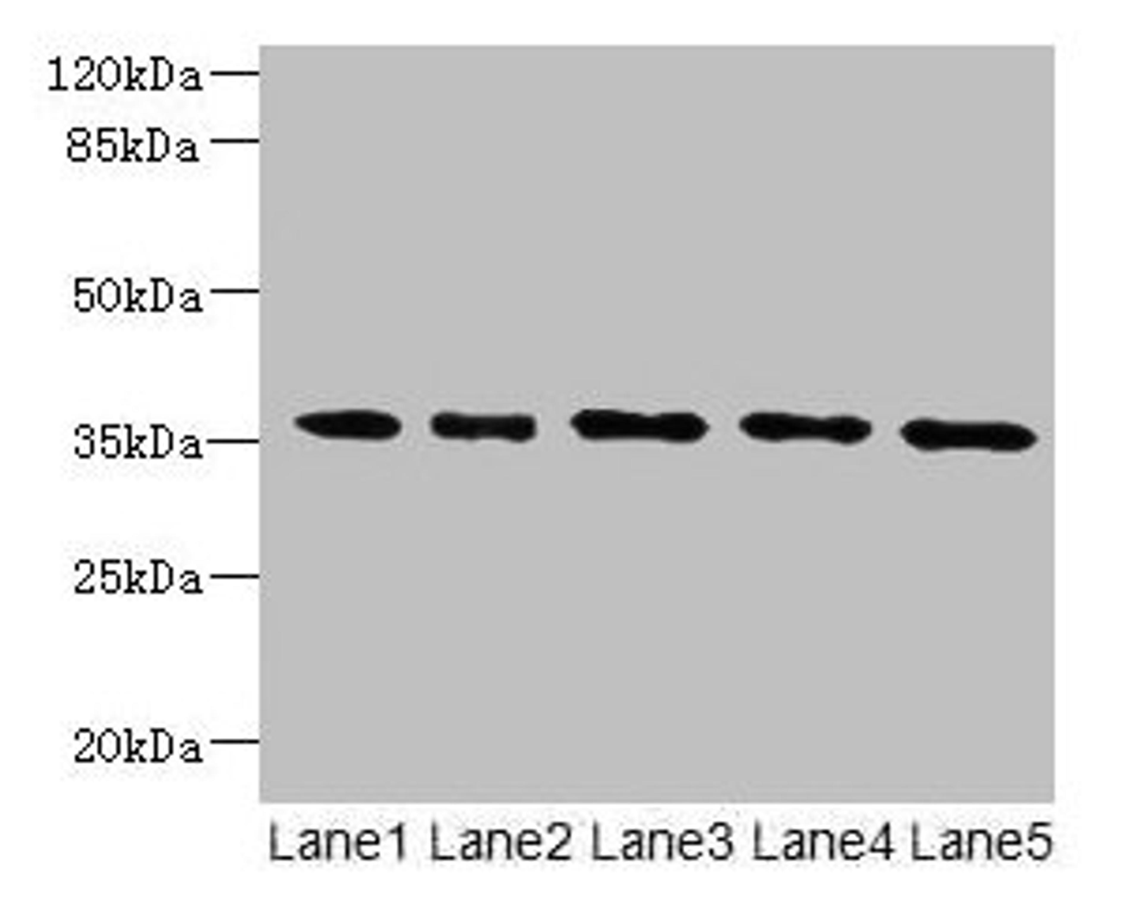 Western blot. All lanes: OXNAD1 antibody at 4µg/ml. Lane 1: Mouse large intestine tissue. Lane 2: Mouse lung tissue. Lane 3: K562 whole cell lysate. Lane 4: U251 whole cell lysate. Lane 5: A549 whole cell lysate. Secondary. Goat polyclonal to rabbit IgG at 1/10000 dilution. Predicted band size: 35 kDa. Observed band size: 35 kDa