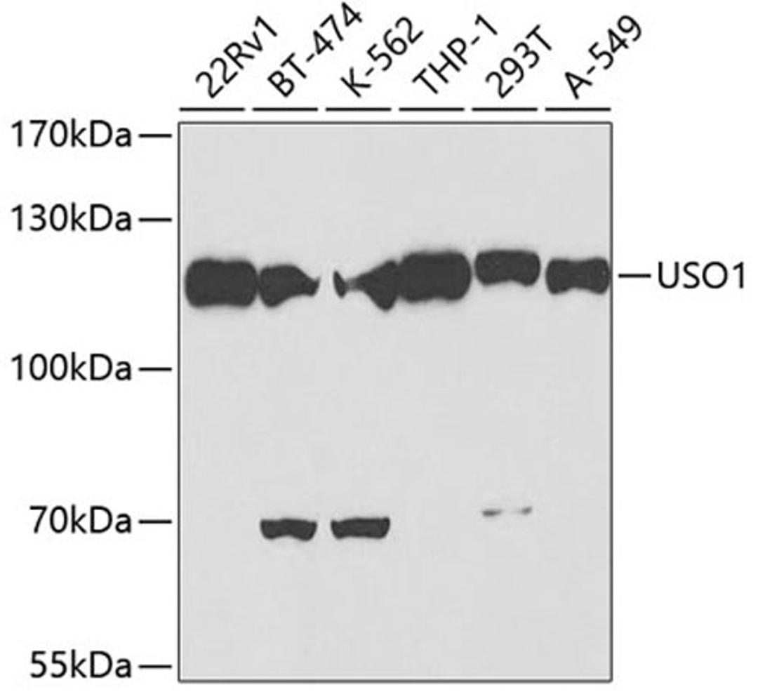 Western blot - USO1 antibody (A2796)