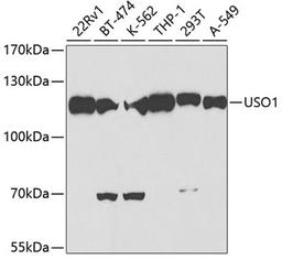 Western blot - USO1 antibody (A2796)