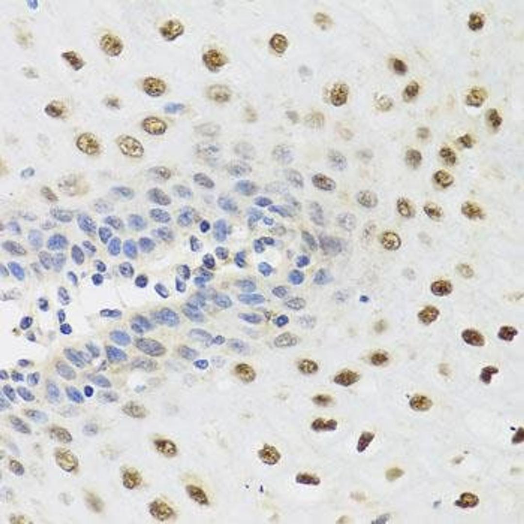 Immunohistochemical staining of human esophagus tissue using YTHDF3 antibody (dilution of 1:100)