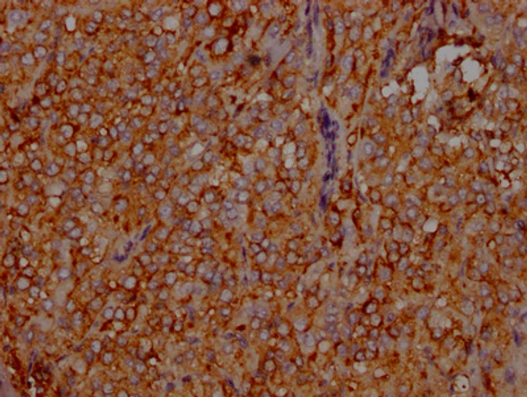 IHC image of CSB-RA575353A0HU diluted at 1:100 and staining in paraffin-embedded human adrenal gland tissue performed on a Leica BondTM system. After dewaxing and hydration, antigen retrieval was mediated by high pressure in a citrate buffer (pH 6.0). Section was blocked with 10% normal goat serum 30min at RT. Then primary antibody (1% BSA) was incubated at 4℃ overnight. The primary is detected by a Goat anti-rabbit IgG polymer labeled by HRP and visualized using 0.05% DAB.