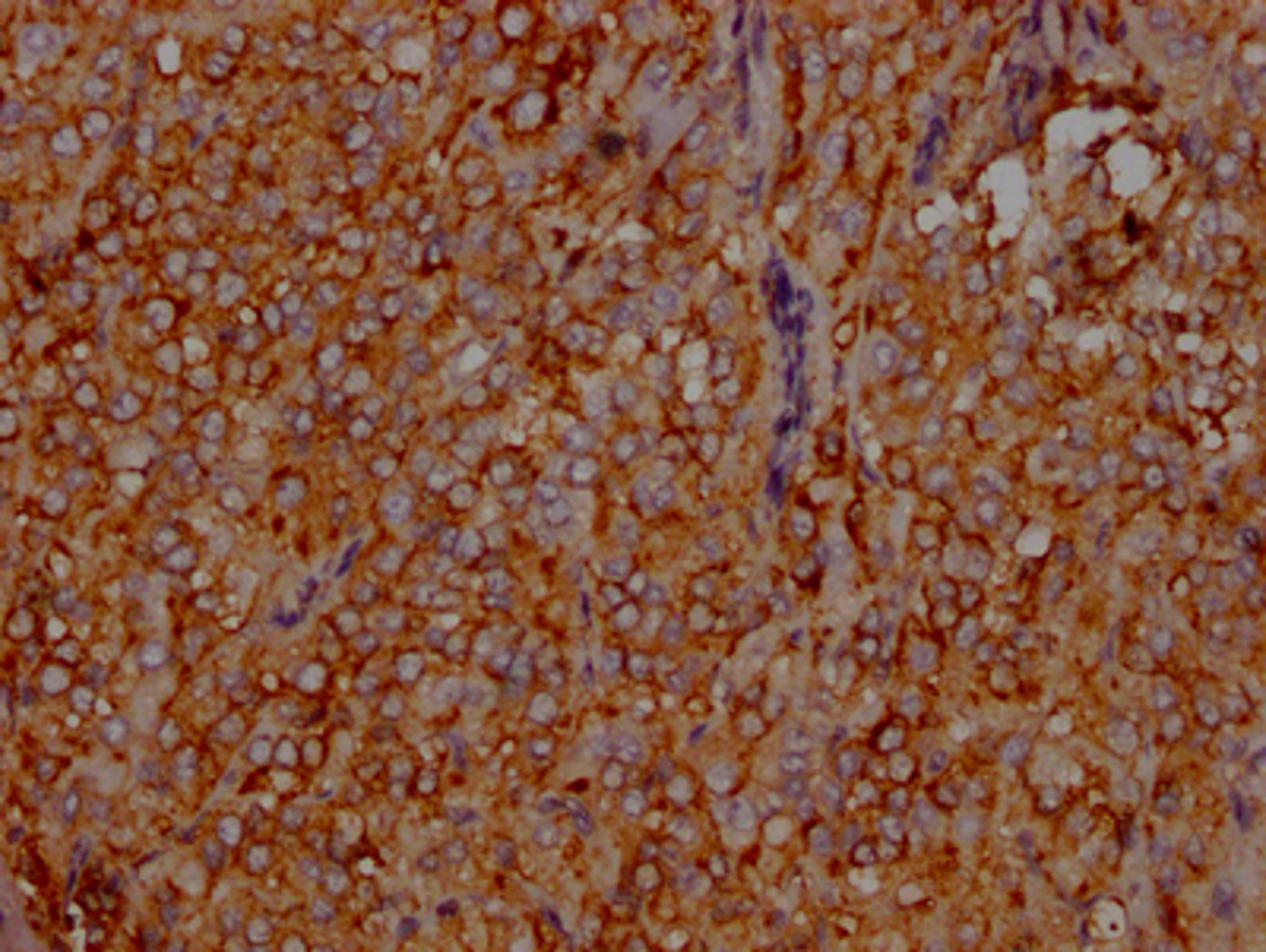 IHC image of CSB-RA575353A0HU diluted at 1:100 and staining in paraffin-embedded human adrenal gland tissue performed on a Leica BondTM system. After dewaxing and hydration, antigen retrieval was mediated by high pressure in a citrate buffer (pH 6.0). Section was blocked with 10% normal goat serum 30min at RT. Then primary antibody (1% BSA) was incubated at 4℃ overnight. The primary is detected by a Goat anti-rabbit IgG polymer labeled by HRP and visualized using 0.05% DAB.